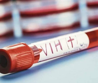 Diagnostica SSG 357 casos nuevos de VIH durante 2018