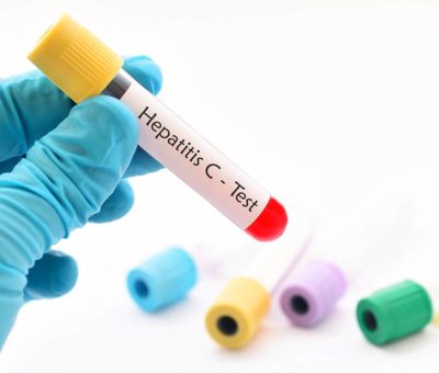 Logra IMSS eliminar virus de Hepatitis C  
