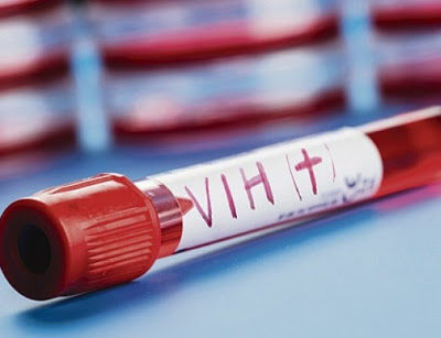Garantiza SSG atención médica a pacientes con VIH