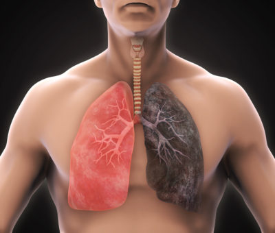 Covid-19 oportunidad para dejar el cigarrillo, afecta a personas con el sistema respiratorio comprometido.
