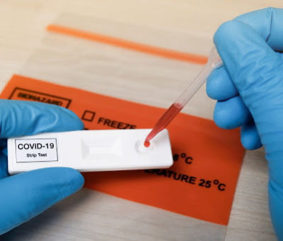 Sólo el 7 por ciento de la población sueca han generado anticuerpos contra el Coronavirus
