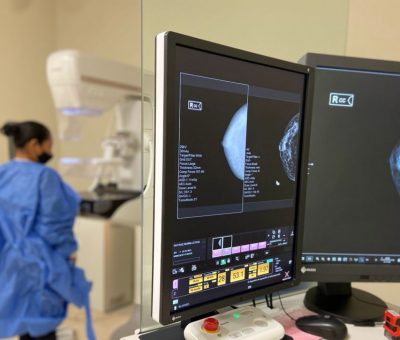 Mastografía importante para la detección oportuna del cáncer de mama: IMSS Guanajuato