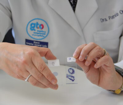 SSG promueve en mujeres guanajuatenses la detección oportuna de cáncer cervicouterino
