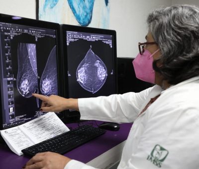 Cuenta IMSS Guanajuato con personal y equipamiento necesarios para prevenir cáncer de mama
