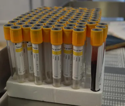 SSG practica más de 10 mil procedimeintos para detectar a tiempo cáncer de mama y cervicouterino.